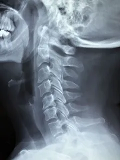 医生、医院、护士、医学、x光、医疗保健、疾病、专业人员