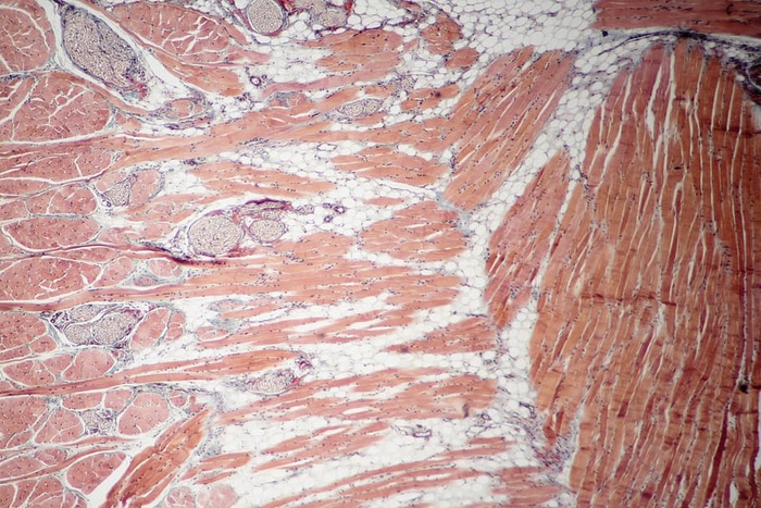 肌肉组织的固定玻片横截面，100倍显微镜视图