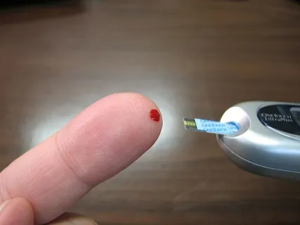 人,检查,血糖,糖尿病,血液,葡萄糖,测试,血糖,血液,葡萄糖 人,检查,血糖,糖尿病,血液,葡萄糖,测试,血糖,血液,葡萄糖