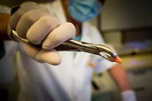 个人，手持，银钳子，牙齿，牙医，牙齿，牙齿，医疗保健