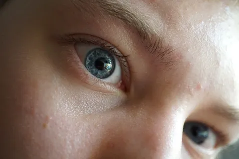 皮肤，隐形眼镜，人，人，脸，唇，嘴，蜡笔