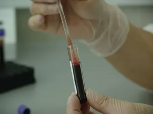 人员，手持，试管，血液，小瓶，分析，实验室，测试