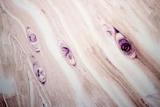 组织内旋毛虫病寄生虫