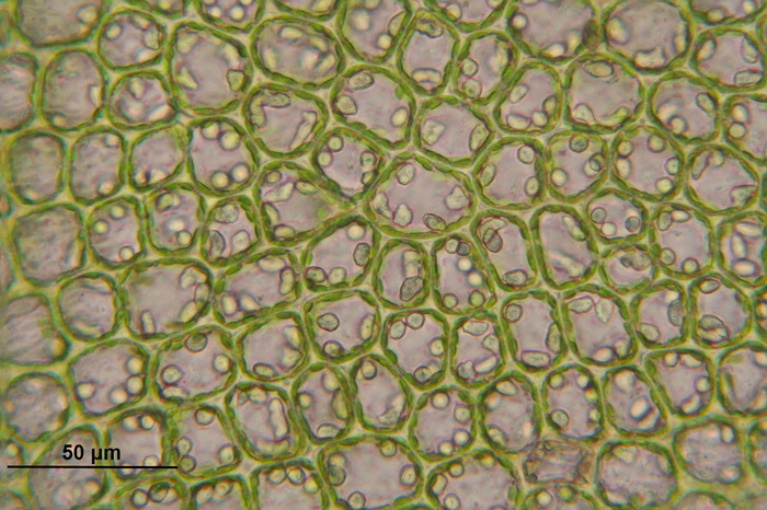 巴比洛phozia，细胞，苔类，巴比洛phozia floerkei，显微镜，宏观，生物学，科学