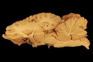 大脑，马，解剖学，杰欣，马，解剖学，准备，头部，大脑