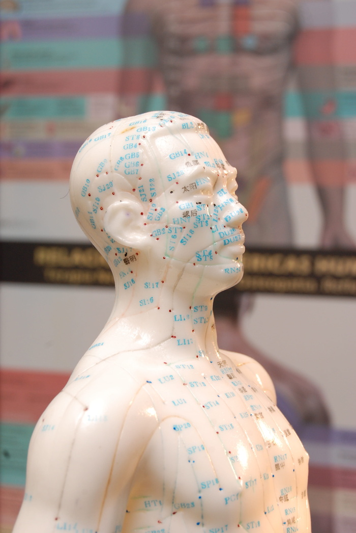 针灸，医学替代品，针灸，医学，替代品，医学替代品，生物能量学，人体模型，例如