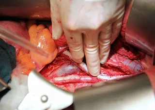 血管外科，手，外科，医生，外科医生，手术，医院，器官