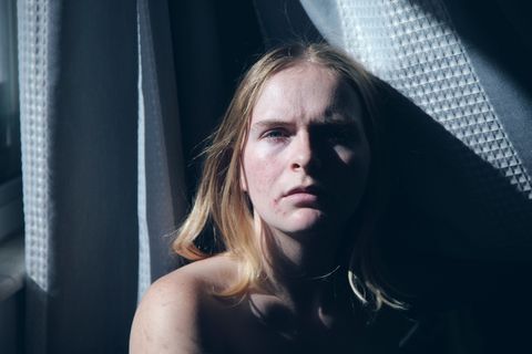 夏令时、痤疮、咨询、抑郁症、精神疾病、女人、人、情绪化