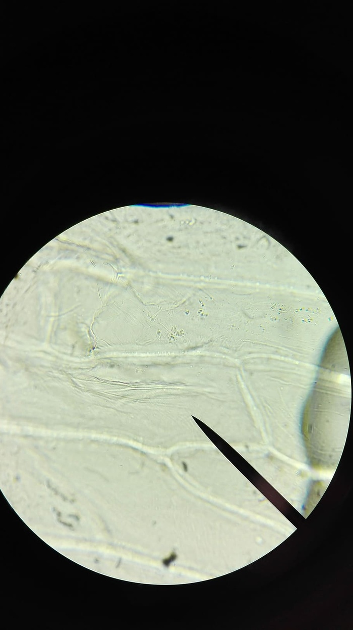显微镜，细胞，探索，检查，放大，针头，微生物学，黑色背景