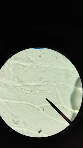 显微镜，细胞，探索，检查，放大，针头，微生物学，黑色背景