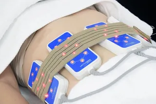 白色，医疗，设备，腹部，空洞，激光脂溢，乳晕，空泡