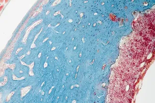 股骨的固定滑动横截面。