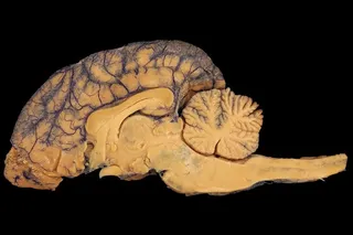 棕色大脑插图，大脑，解剖学，狗，恋童癖，马，生物学，背部