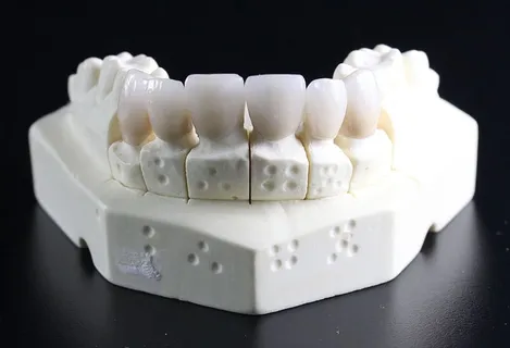 白色,义齿,桌子,桌面,牙齿替换,牙齿,牙科技师,室内 白色,义齿,桌子,桌面,牙齿替换,牙齿,牙科技师,室内