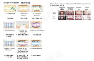 牙齿效果图图片