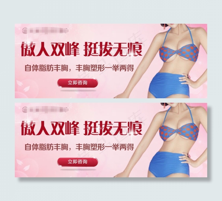 自体脂肪丰胸bannerpsd模版下载