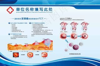 医院展板之TCT宫颈癌筛查
