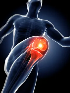 身体器官X光片-高清图片