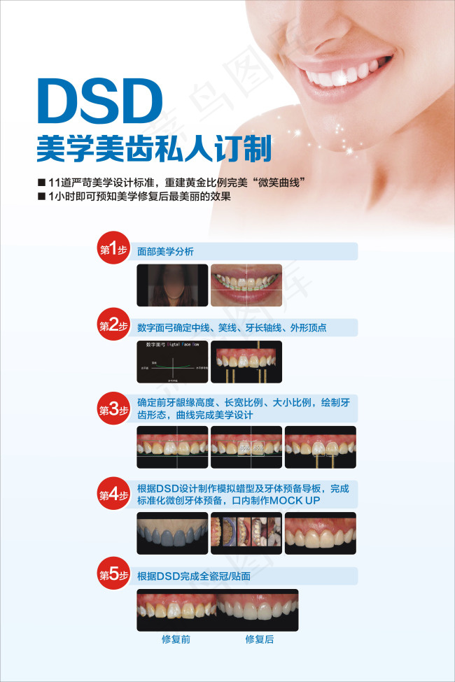 DSD美学美齿展板cdr矢量模版下载