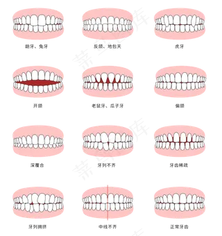 需要矫正的牙齿症状图集