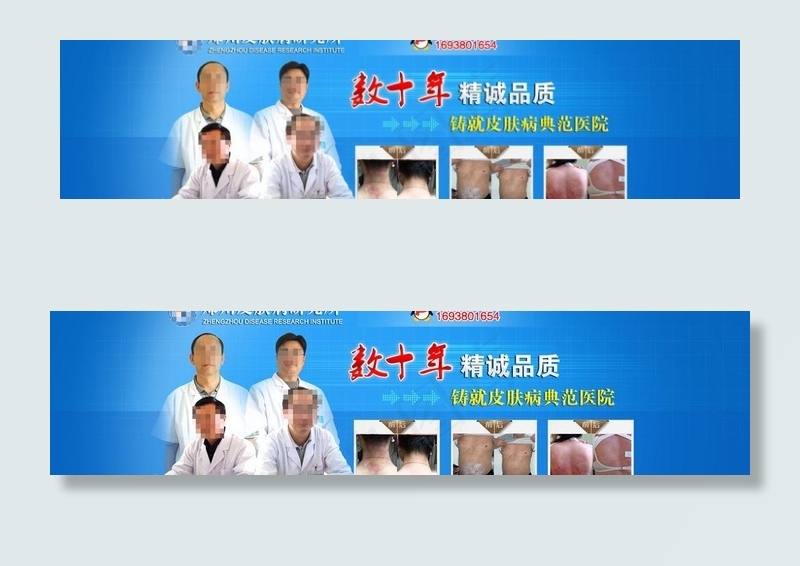 皮肤病banner图片psd模版下载