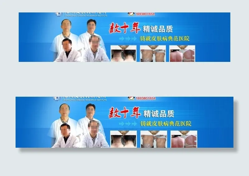 皮肤病banner图片psd模版下载