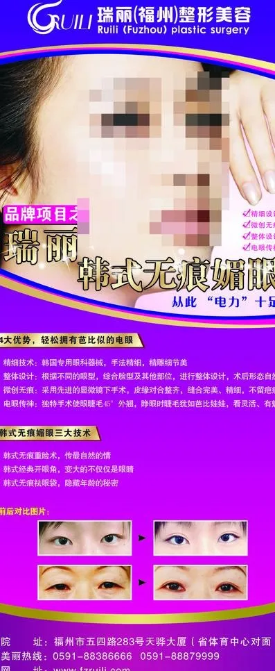 双眼皮项目x展架图片(800X1800)cdr矢量模版下载