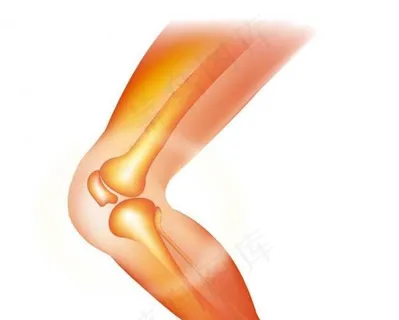 关节图片