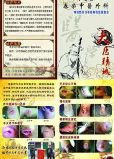 中医诊所宣传图片