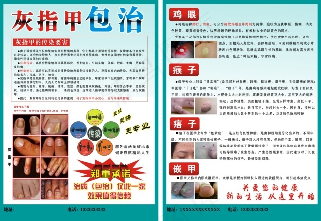 灰指甲宣传单cdr矢量模版下载
