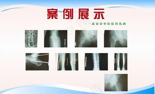 中医院案例展示图片