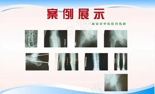 中医院案例展示图片