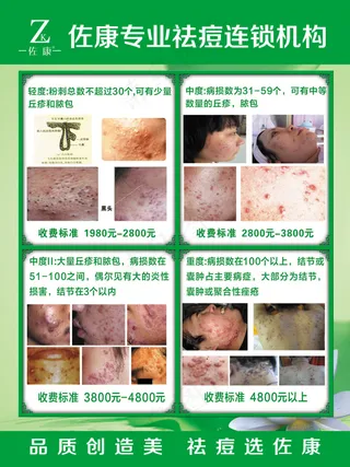 佐康痘痘级别图海报