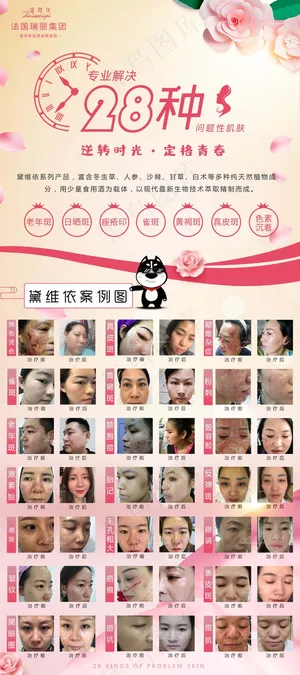 祛斑 祛痘  美容前后对比图  