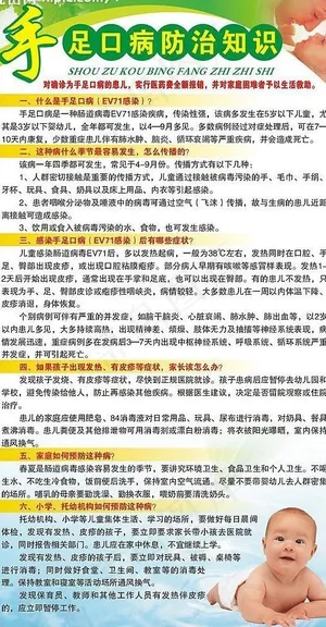 手足口病宣传x展架图片