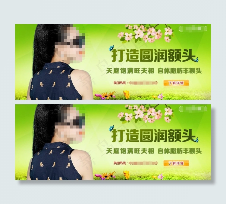 自体脂肪丰额头psd模版下载