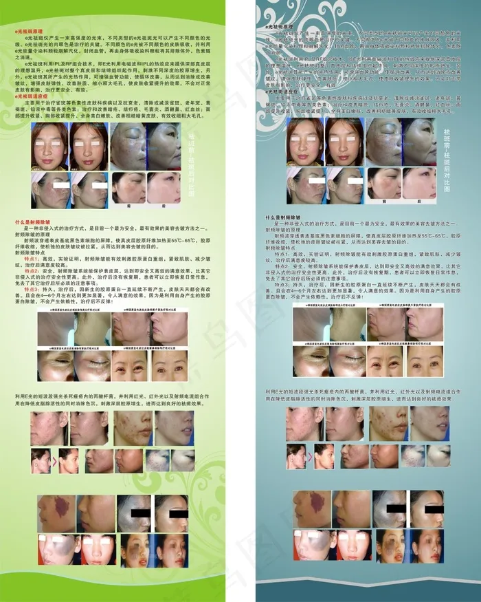 祛痘X展架cdr矢量模版下载