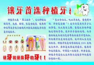 牙科种植牙宣传海报设计高清PSD下...