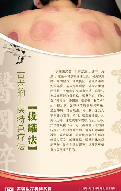 中医拔罐图片(3543X5316(DPI:150))psd模版下载