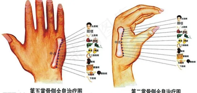 手掌反射区全息治疗图图片