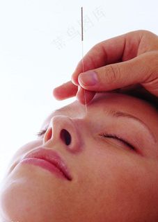 针灸图片