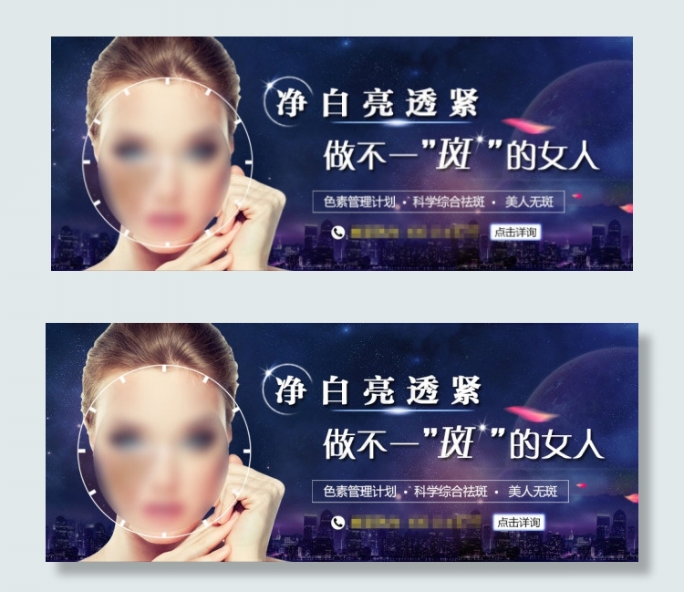 祛斑整形bannerpsd模版下载