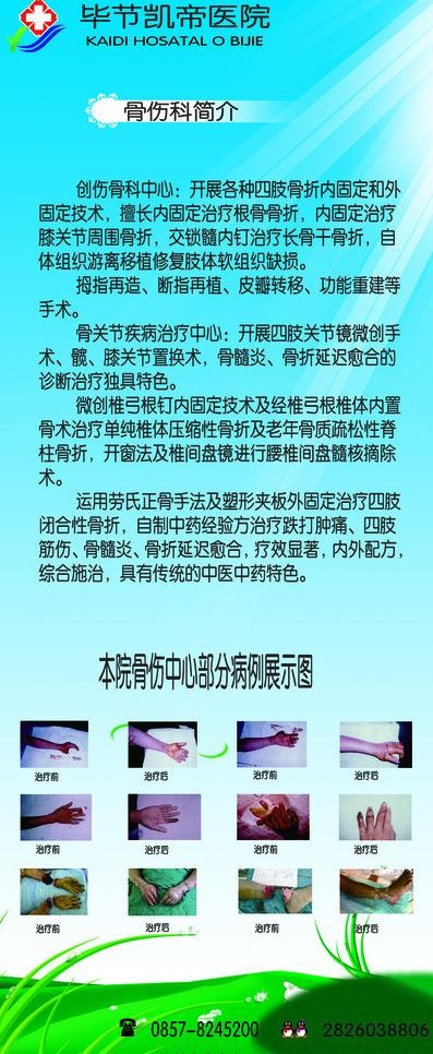 骨伤科x展架图片(9449X21260(DPI:300))psd模版下载