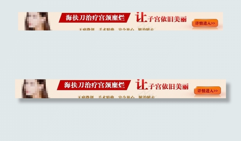 无痛人流banner图片psd模版下载
