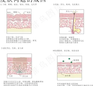 皮肤问题图解图片