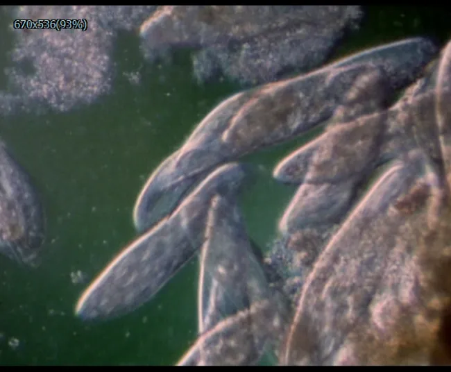 显微镜下的微生物