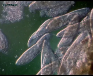 显微镜下的微生物