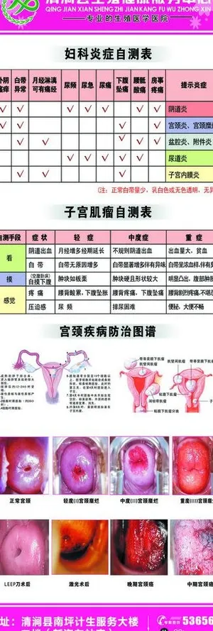 妇科x展架图片