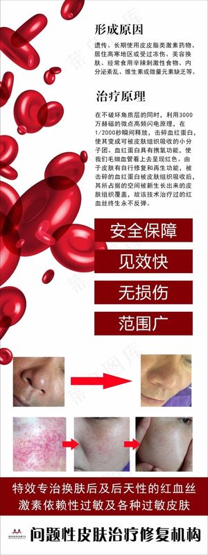 红血丝 简约 医疗 美容 x展架