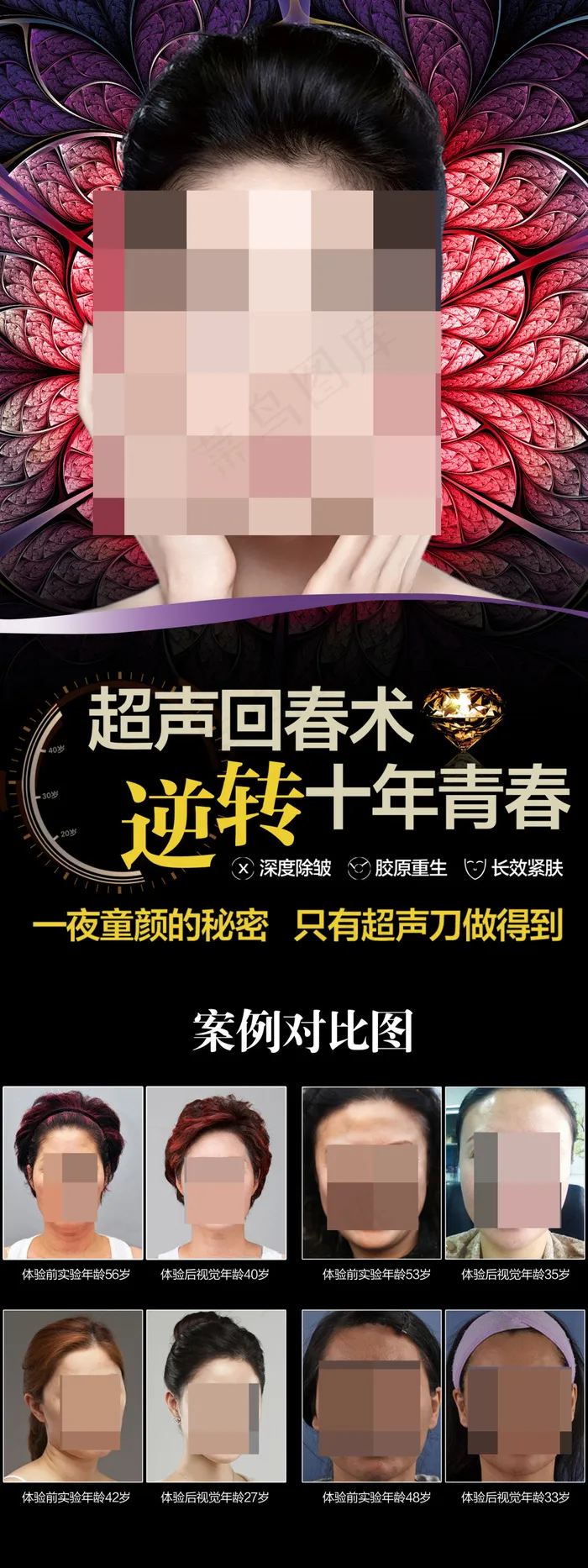 超声刀除皱抗衰老X展架超声刀(1701X4535(DPI:72))psd模版下载
